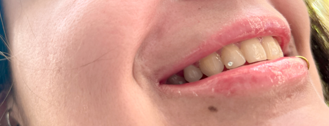 brillo-el-los-dientes