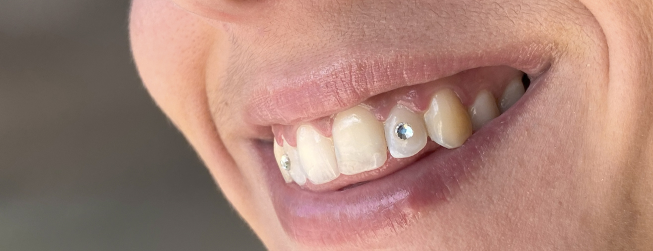 tooth gems madrid