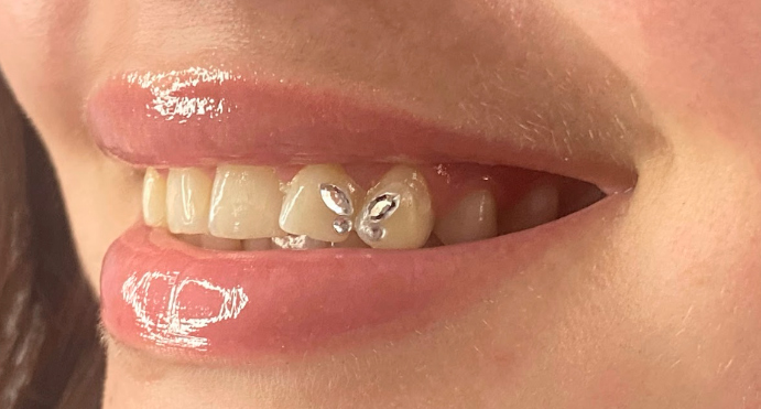 GEMAS-DENTALES-MENORCA-