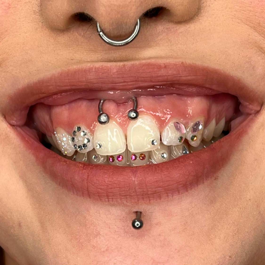 diseños-tooth-gems-murcia