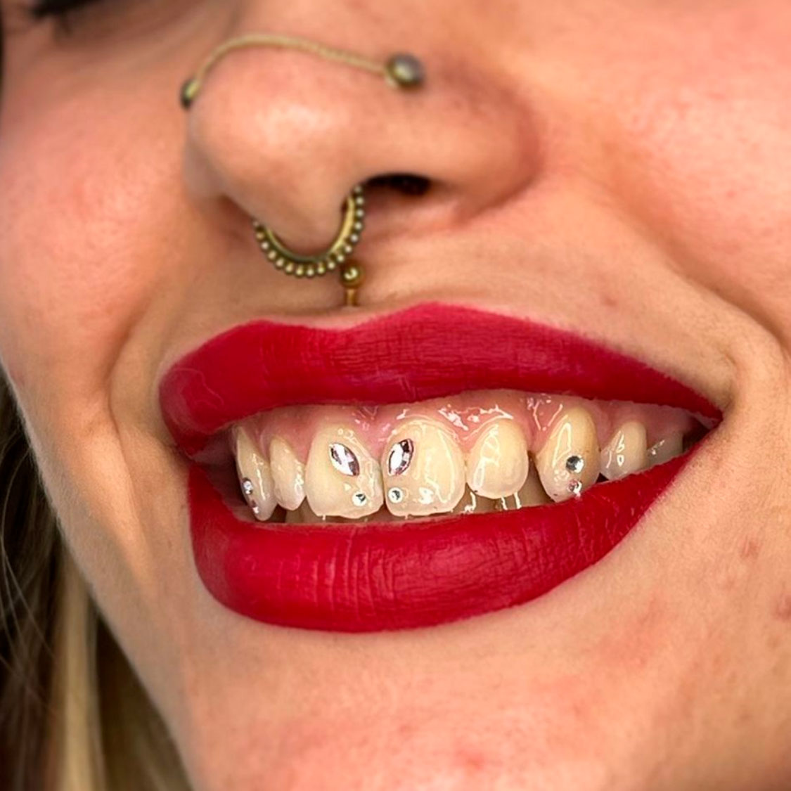 tooth-gems-murcia