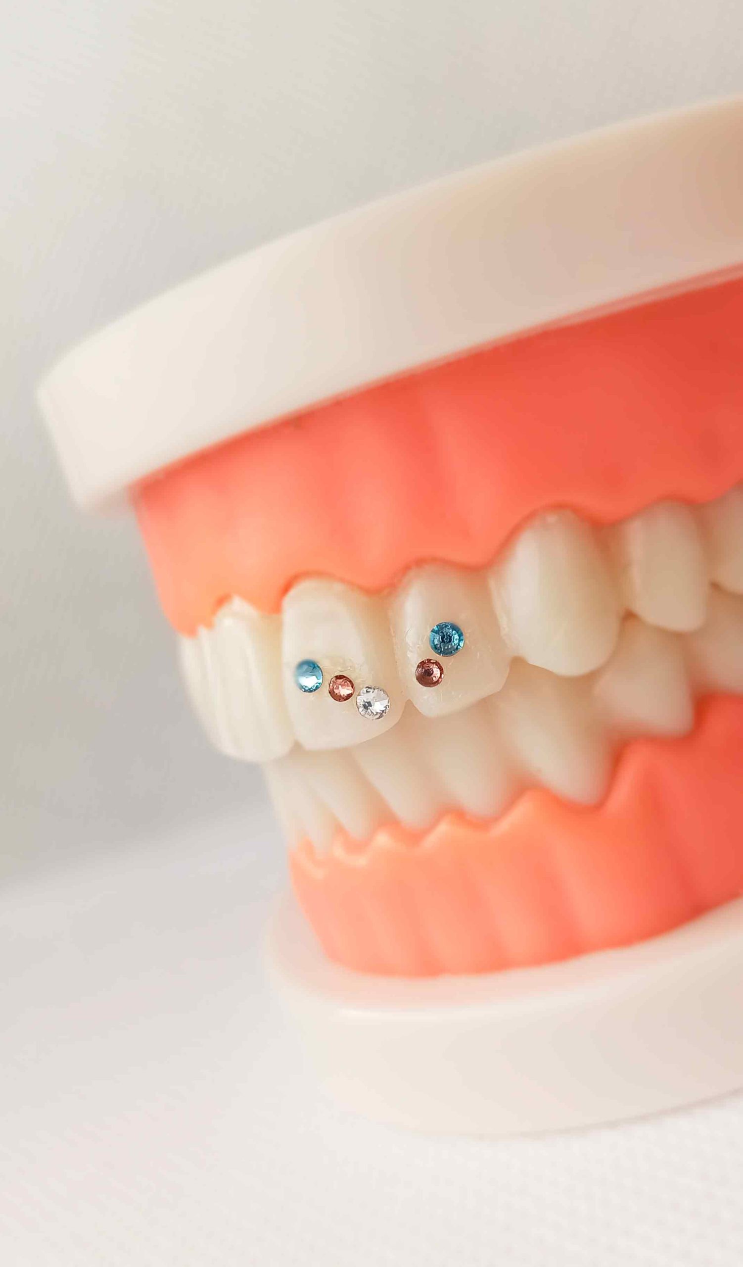 promocion-tooth-gems-madrid2