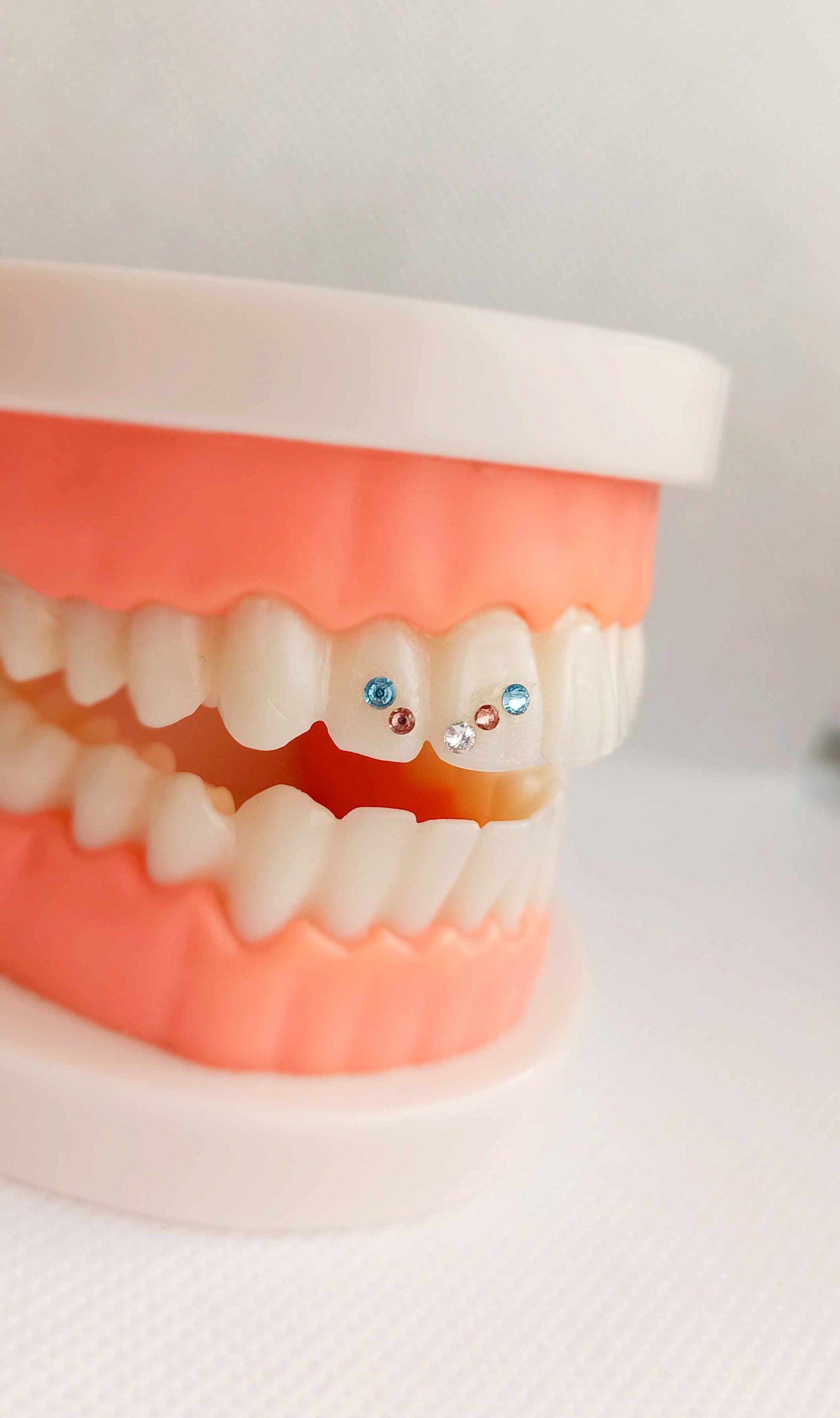 promocion-tooth-gems-madrid3